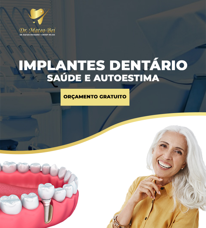 Implantes Dentários - Clínica Odontológica Dr. Mateo Bei